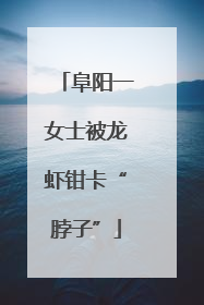 阜阳一女士被龙虾钳卡“脖子”